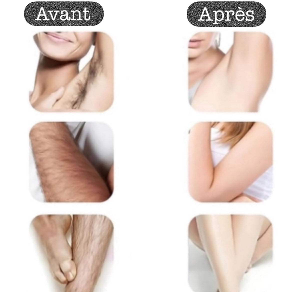 Appareil, avec recharge USB, rasage sans douleur visage et corps pour tous types de peaux