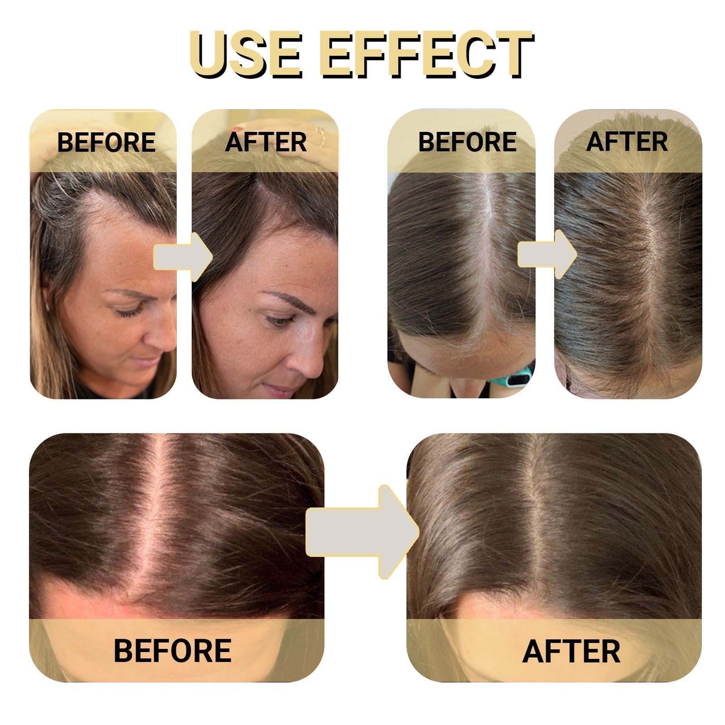 Huile fortifiante pour la pousse des cheveux, cils et toute croissance : Unisex