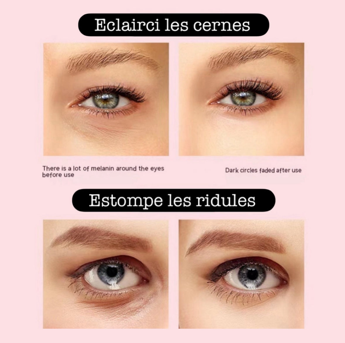 Baguette magique 4 in 1 soin thérapie infrarouge visage  3 couleurs - pour hommes et femmes, pour vous ou à offrir - Beauty Diams .com